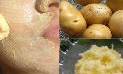 Отбеливающая маска от купероза из сырого картофеля