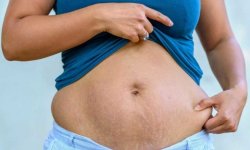 5 упражнений, чтобы забыть о «фартуке» на животе после родов