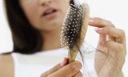 Пять домашних средств, чтобы предотвратить выпадение волос в межсезонье
