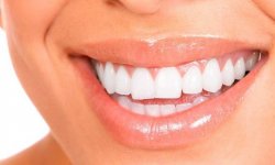 Как отбелить зубы в домашних условиях: простые и доступные способы