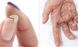 Как избежать ломкости волос и ногтей во время похудения