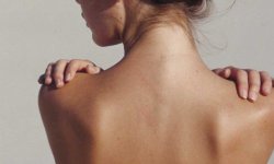 Как натуральные средства помогут в борьбе с высыпаниями на спине
