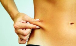 Подтяжка кожи после похудения, общие рекомендации и домашние методы