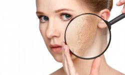 Восстанавливаем пересушенную кожу лица с помощью домашних средств