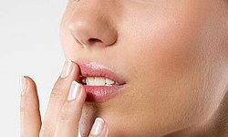 Герпес на губах – капризное заболевание