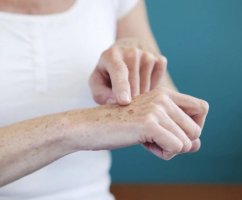 Как удалить возрастные пятна с кожи рук в домашних условиях