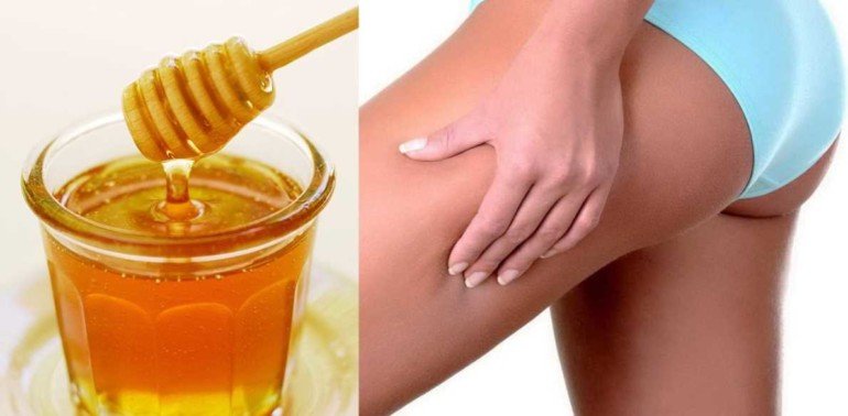Как делать медовые обертывания против валиков над коленями