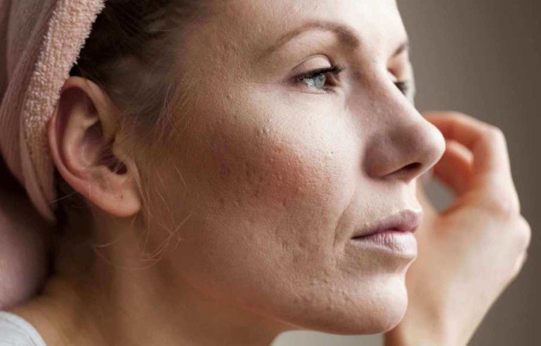 Почему на диете кожа становится тусклая и как этого избежать