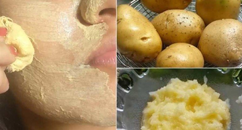 Сырой картофель на страже молодости кожи: самая простая маска от морщин